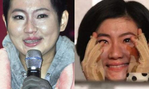 任家萱selina烧伤什么部位(任家萱selina烧伤好了吗)