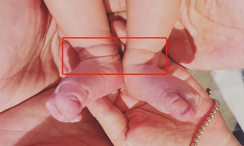 王彦霖宣布与艾佳妮结婚(王彦霖分享与艾佳妮幸福日常)