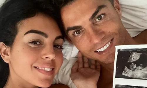 c罗年轻长发(c罗目前有多少个小孩)