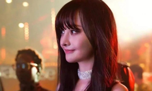 郑爽被烧伤后发生了什么事?知情人透露了真相。