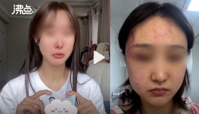 网络名人实名举报信息是家暴。她丈夫对该事件的回应是谁?