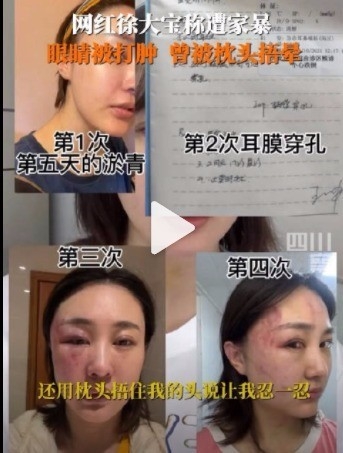 网络名人实名举报信息是家暴。她丈夫对该事件的回应是谁?