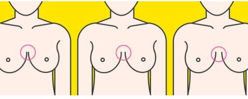 外八胸型好吗(外扩胸型穿什么内衣)