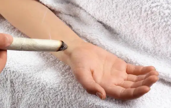 三伏灸开始时间(今年三伏天什么时候开始)