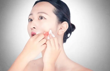 脸两边长痤疮是什么原因(脸颊两侧起痤疮的原因)