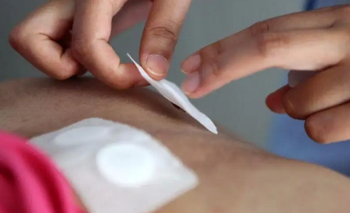 2022年三伏贴怎么贴(2022年三伏贴销售)