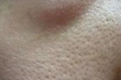 运动能收缩毛孔(运动能收缩毛孔么)