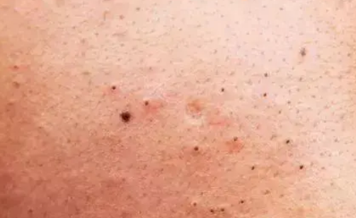 运动能收缩毛孔(运动能收缩毛孔么)