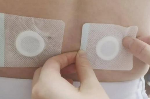 三伏贴一次可以贴几个穴位(三伏贴一次可以贴几个位置)