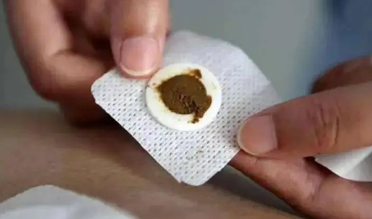 三伏贴一定要贴正确位置才有效吗(三伏贴一定要贴完整疗程吗)