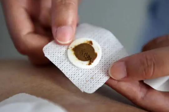 三伏贴已贴六年还能继续贴(三伏贴贴够三年然后还要贴吗)