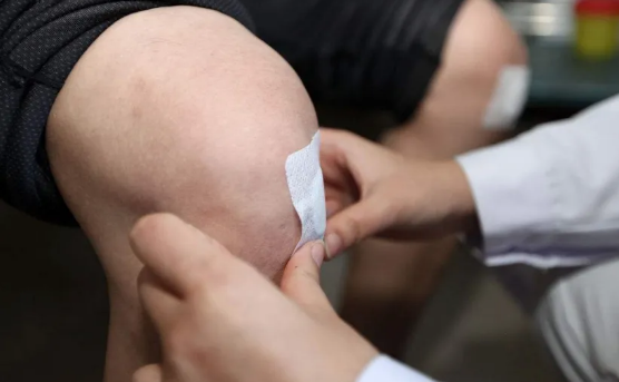 三伏贴只有三伏天才贴么(三伏贴只有三伏天才可以贴吗)