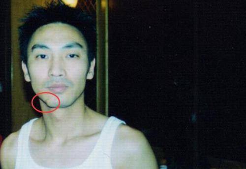 他靠一首歌走红，被搭档毁容，现在身价上亿。