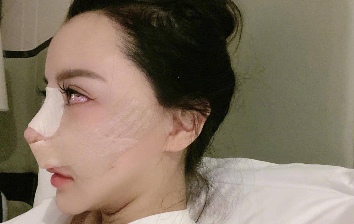 韩安冉的双眼皮(韩安冉脸部做过什么手术)