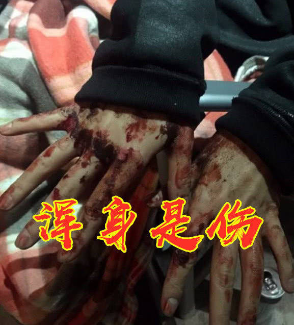 与“死神”赛跑的明星,休遭遇车祸,杨颖遭遇地震。他死里逃生。