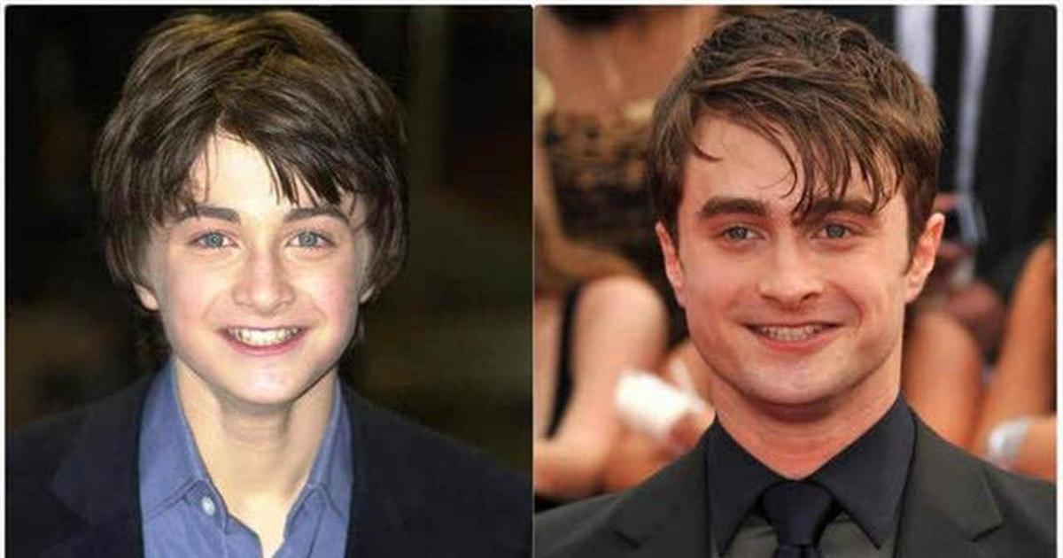 哈利波特已经40岁了。那个小演员当时长什么样?网友:时间是杀猪的。