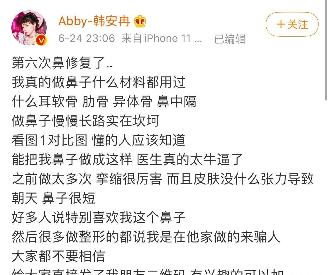 韩安冉的双眼皮(韩安冉脸部做过什么手术)