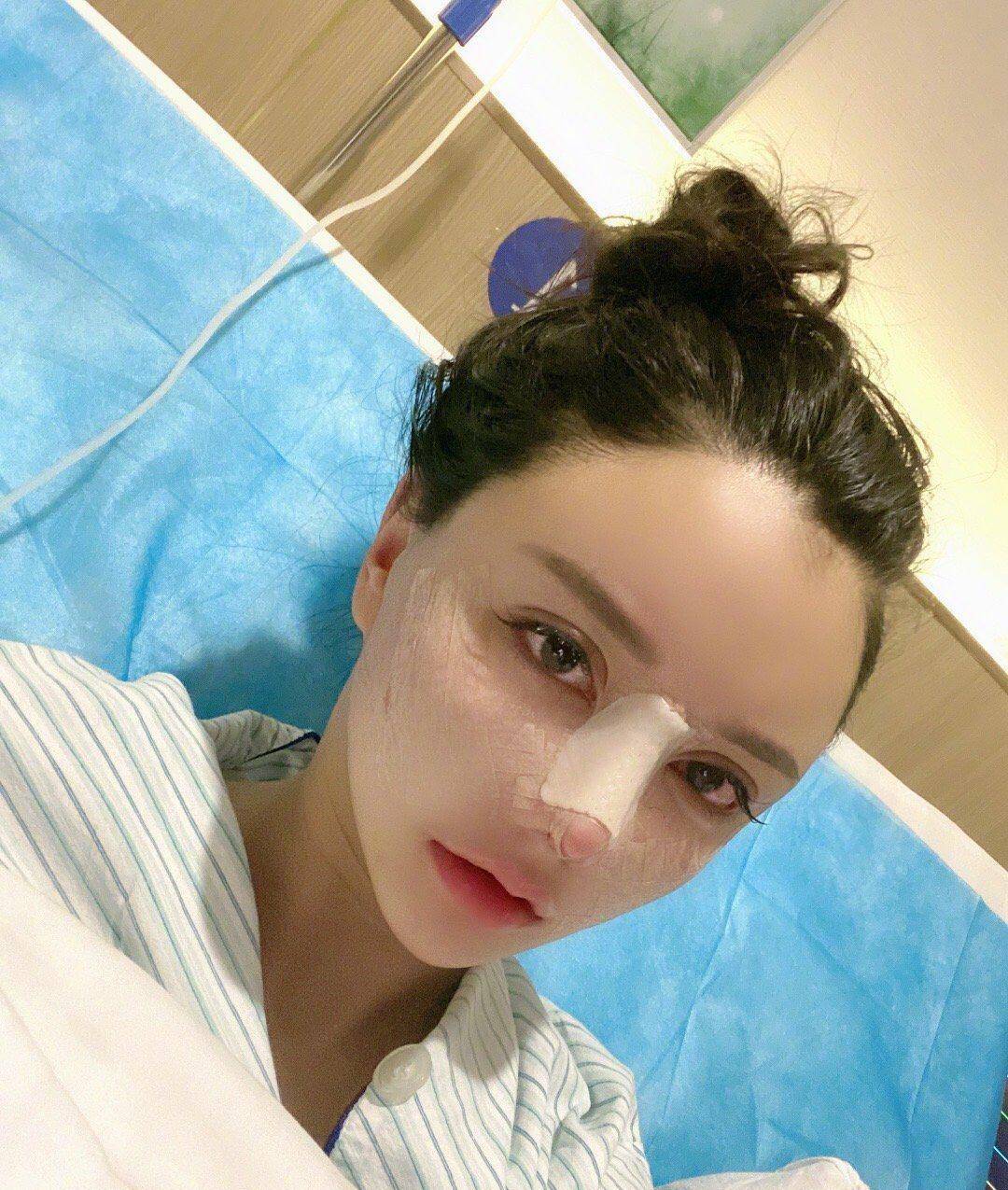 韩安冉的双眼皮(韩安冉脸部做过什么手术)