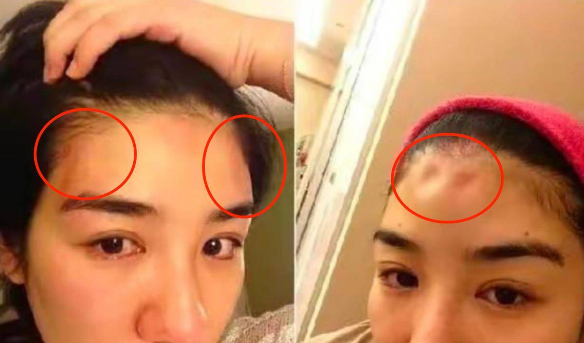 著名女演员希拉被她的前男友强奸了！面部淤青、肿胀、出血都很痛苦。