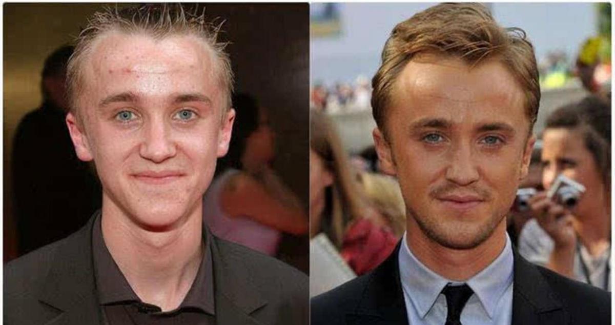 哈利波特已经40岁了。那个小演员当时长什么样?网友:时间是杀猪的。