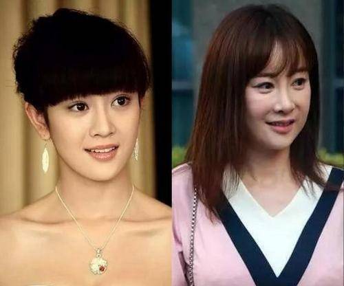 跟制片人撞名的整容女星(去国外当演员)