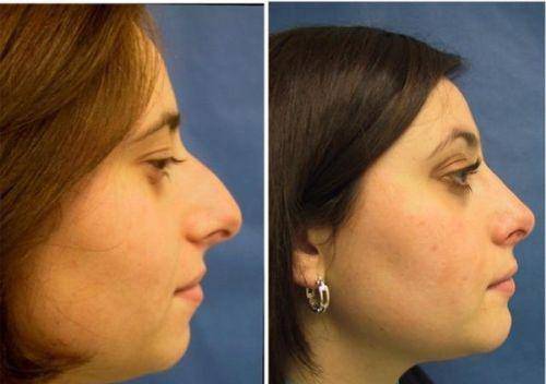 跟制片人撞名的整容女星(去国外当演员)