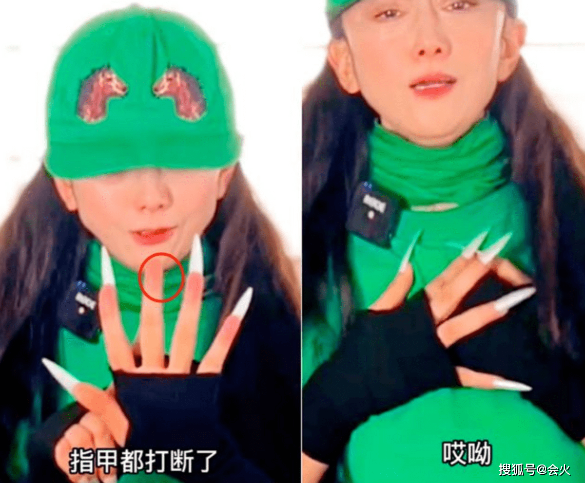 杨丽萍多处骨折(杨丽萍受伤了吗)