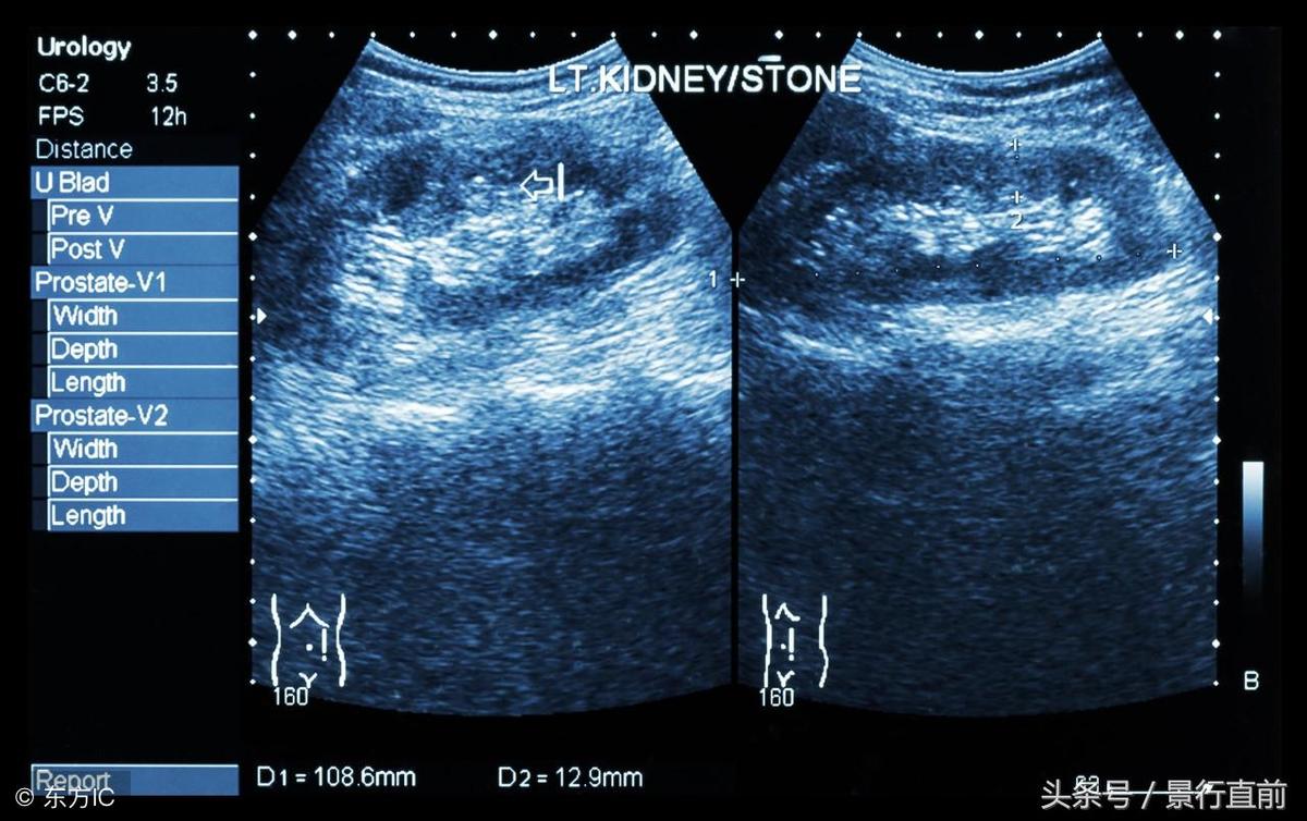 男的长到多少岁不会长高,男生遗传性个子矮