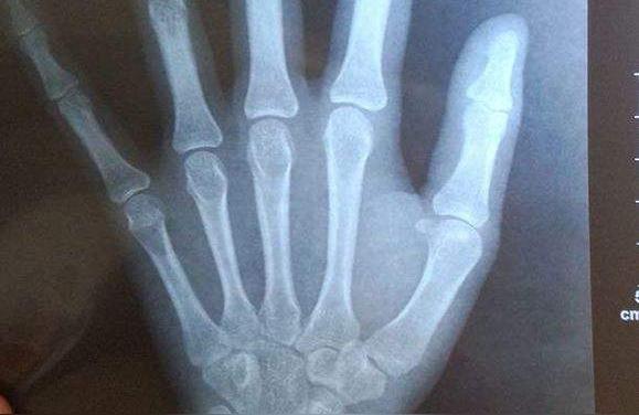 女生身高一般长到几岁就不长了女孩小学四年级正常多高