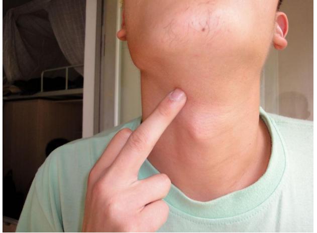 女孩骨骼闭合一般在什么年龄,请问男生骨骼线多大岁数就闭合了