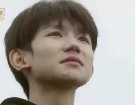 青春期男生皮肤非常差怎么改善,16岁怎样让皮肤可以变更加细腻