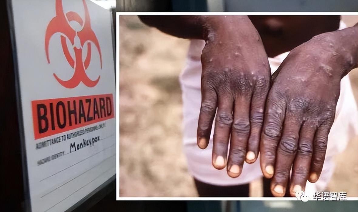 性取向测试15题,有什么好办法吗