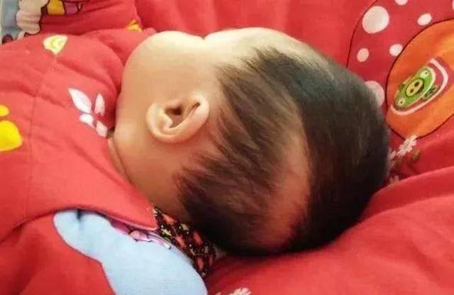 怎么自测骨骺线是否闭合是不是说明骨骺线已经基本闭合了