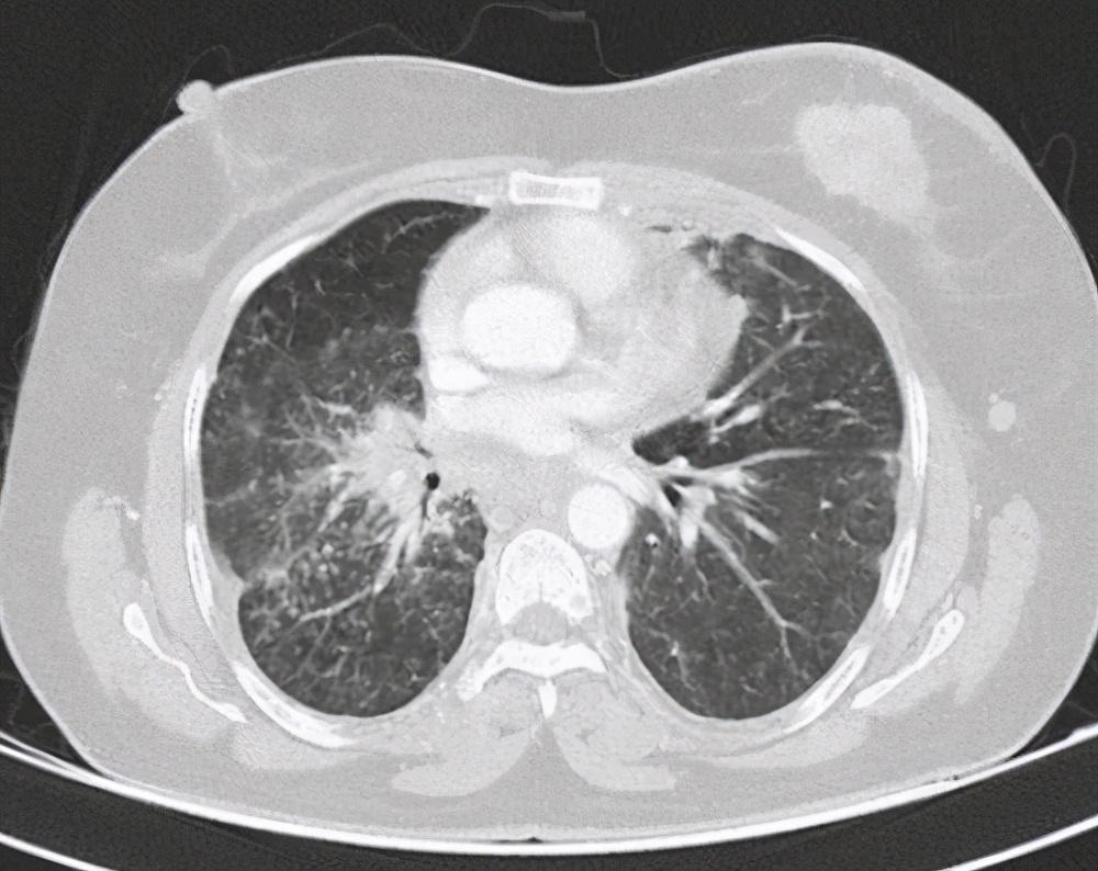 男人喜欢小男孩是不是一种病为什么一和男朋友亲昵就会心里堵得慌