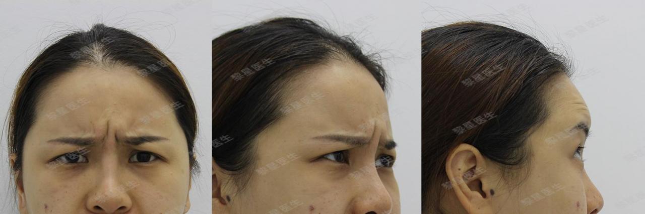 注射生长因子8年了你认为拼多多还能存活多久