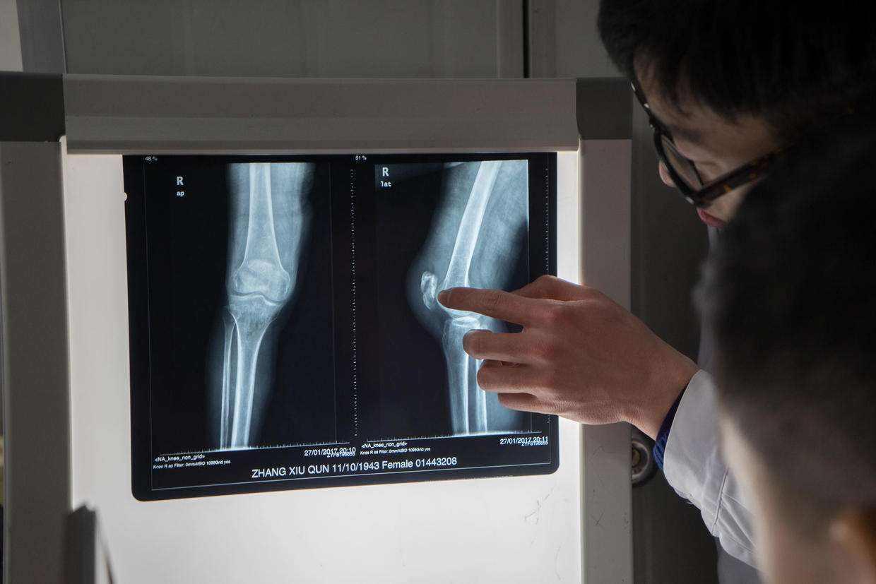 dr检查是什么意思dr头影测量是什么