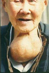 男生的青春期会出现什么现象孩子的青春期从几岁开始