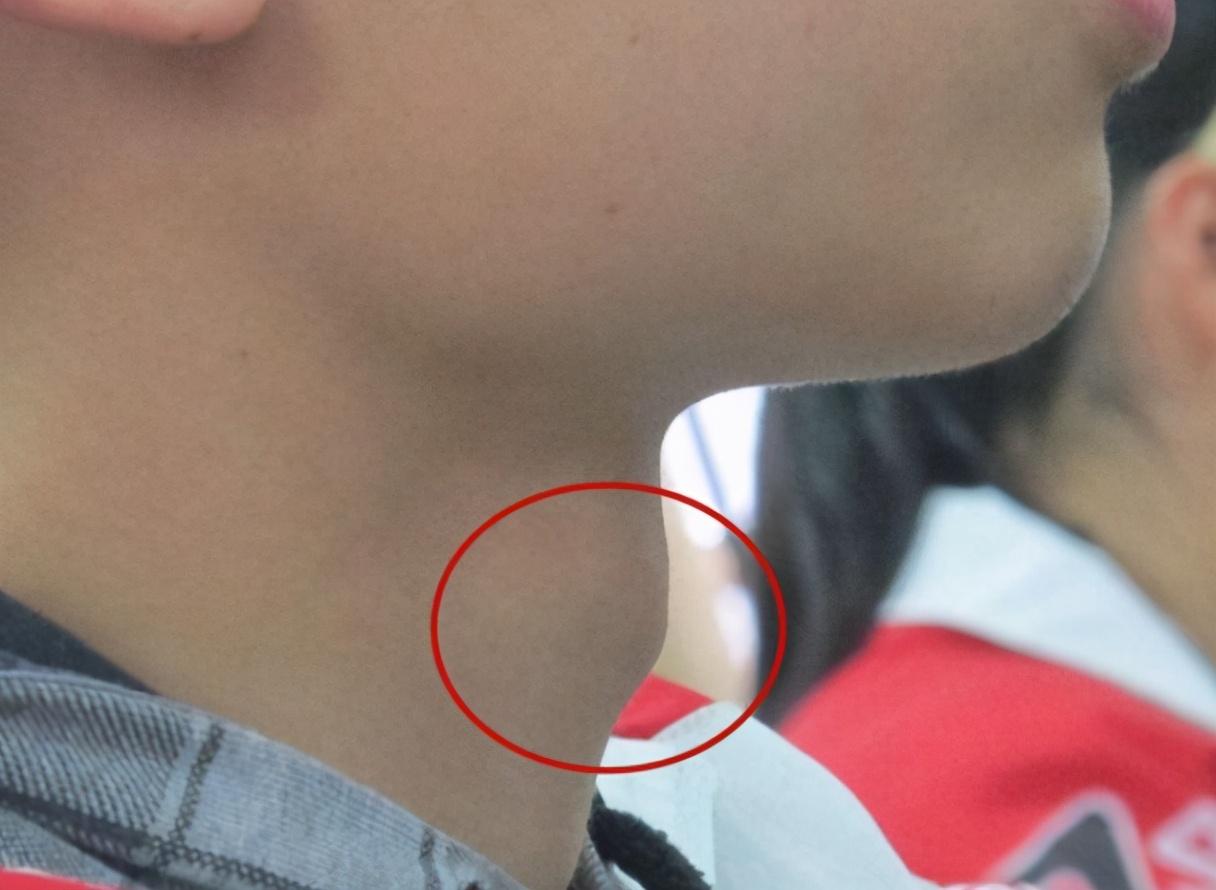 17岁骨缝基本闭合怎么长高17岁1米67还能长多高