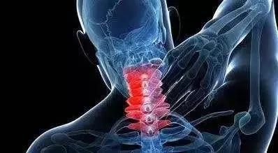 颈椎病如何治疗颈椎病怎么治疗好