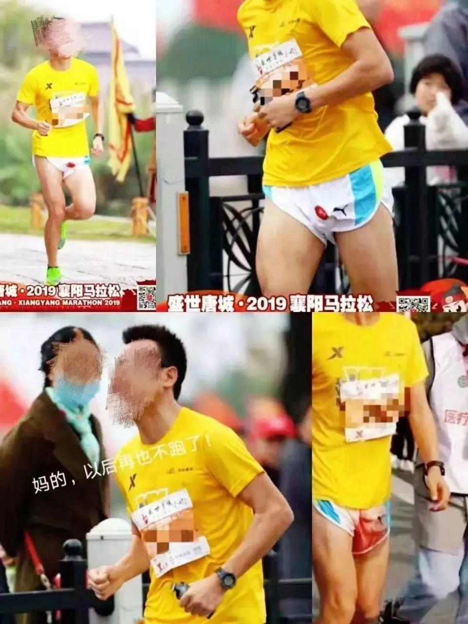 蛋蛋痒痒越抓越痒出血60岁男性换急性伴小便完了以后有点出血会是什么原因