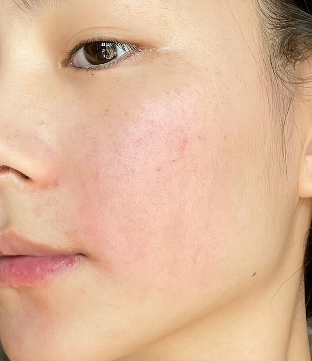 孕妇水乳欧莱雅注光水乳孕妇能用嘛