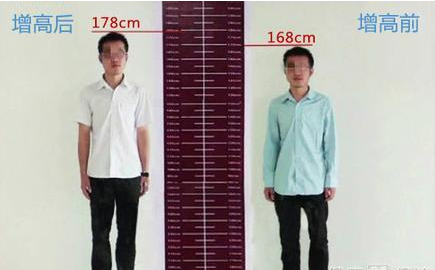 24岁男生怎么长高,14岁1米74还长吗